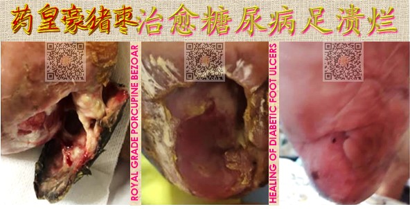 健康是生命之基，是人生幸福的源泉。健康不能代替全部，但是失去了健康就没有健全的体魄与饱满的精神，生命就会黯然失色，生趣索然，仿佛没有了一切。化验报告显示药皇豪猪枣【箭猪枣】含有丰富纯天然氨基酸、钙和锌等❗除此之外，药皇豪猪枣里头不含重金属，也不含有害微生物，绝对能够让您吃🉐安心、吃🉐健康。